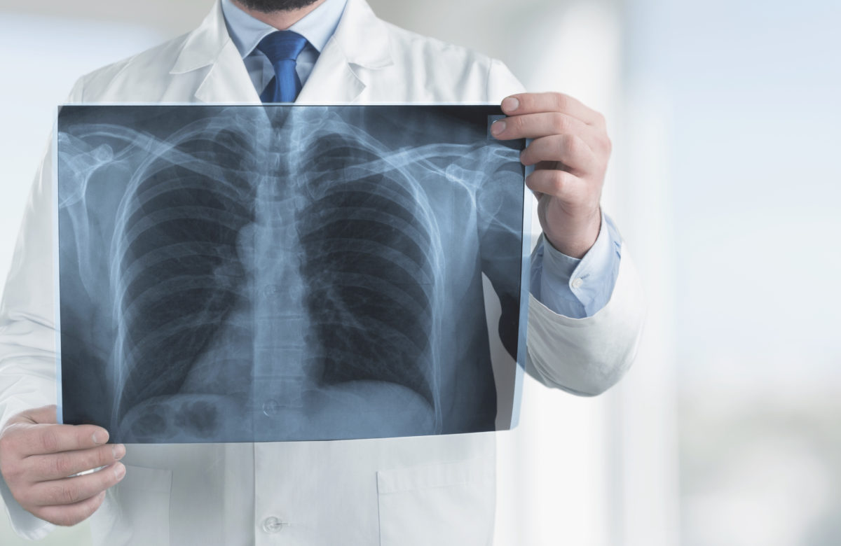 Former Google Engineer Uncovers 96% Of Privacy Altcoin Addresses